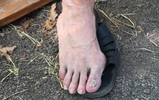 75